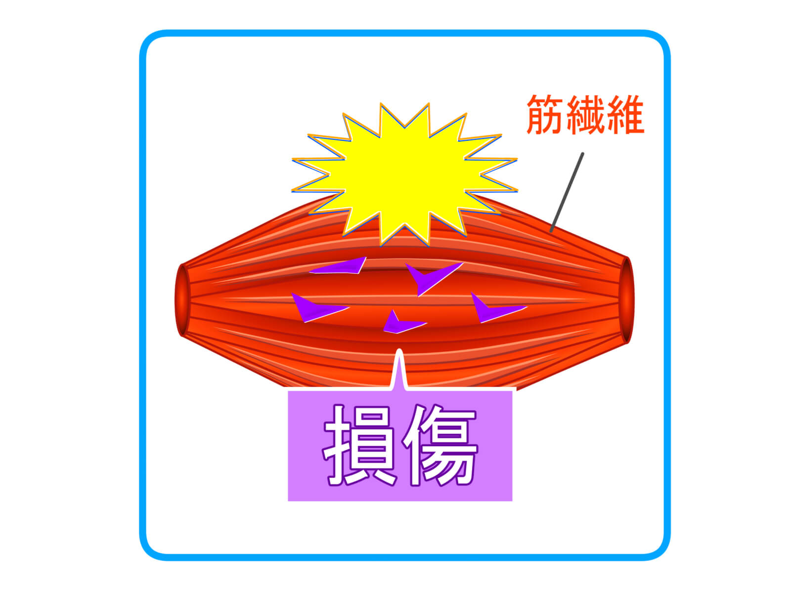 筋肉の炎症